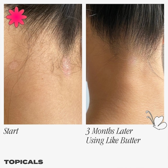 Topicals
Like Butter Mask for Dry, Sensitive & Eczema-Prone Skin 50ml - Picture 6 of 8